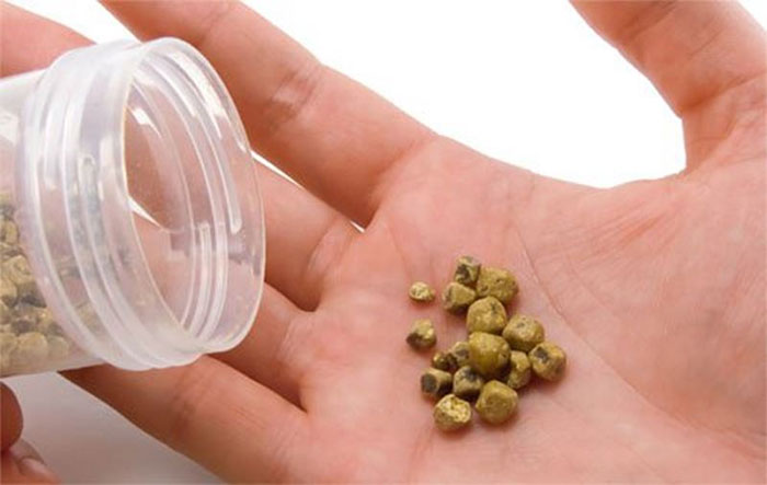 Sỏi mật: Nguyên nhân, triệu chứng và cách điều trị
