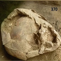 "Mũ bảo hiểm" làm từ hộp sọ hàng nghìn năm trước