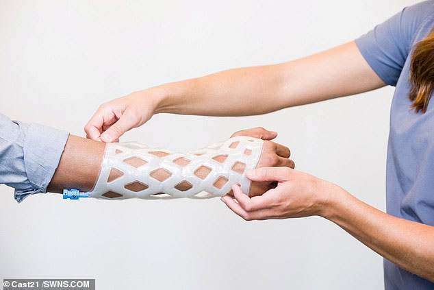 Khuôn bó bột kiểu mới không gây ngứa, không mùi, không cần cắt bằng cưa