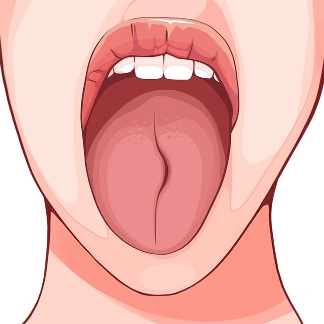 6 sự thay đổi của lưỡi có thể tiết lộ rất nhiều về sức khoẻ