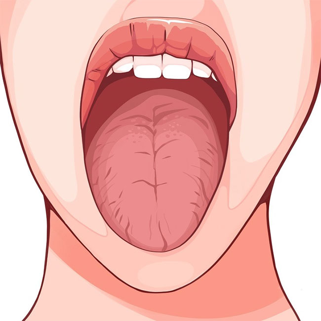 6 sự thay đổi của lưỡi có thể tiết lộ rất nhiều về sức khoẻ