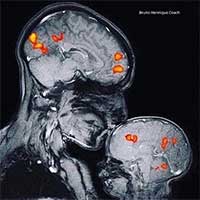 Điều kỳ diệu qua hình ảnh chụp cộng hưởng từ MRI của em bé khi ở bên mẹ