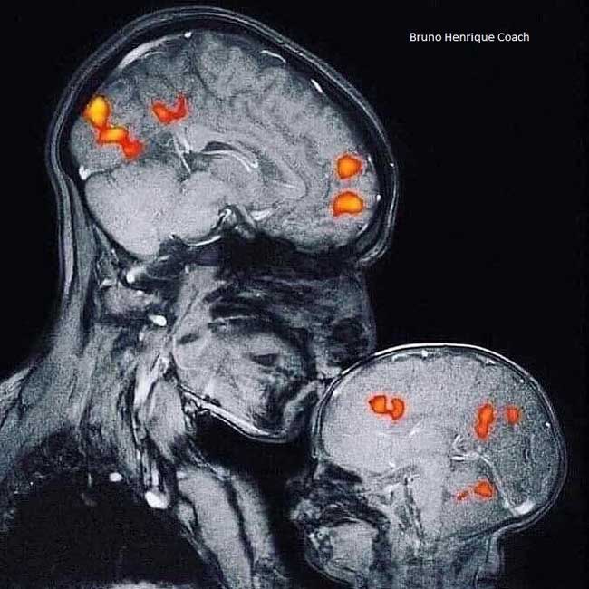 Điều kỳ diệu qua hình ảnh chụp cộng hưởng từ MRI của em bé khi ở bên mẹ