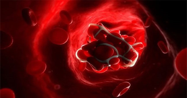 Hiện tượng kỳ quái các phi hành gia gặp phải khi lơ lửng ngoài vũ trụ