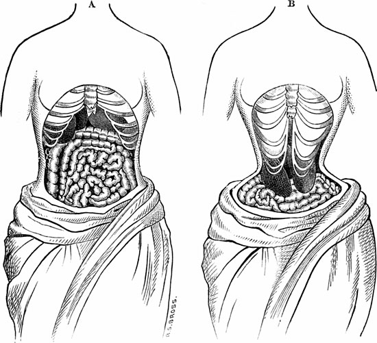 Những xu hướng thời trang chết người trong lịch sử