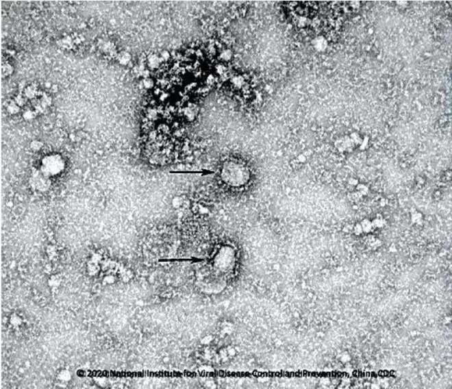 Công bố hình ảnh đầu tiên về virus Corona