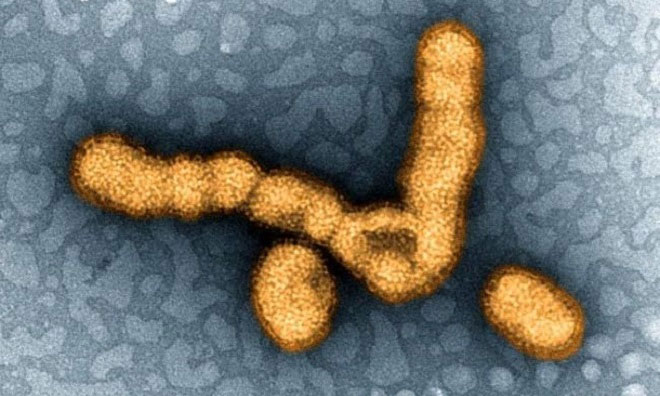 Những loại virus nguy hiểm trên Trái Đất