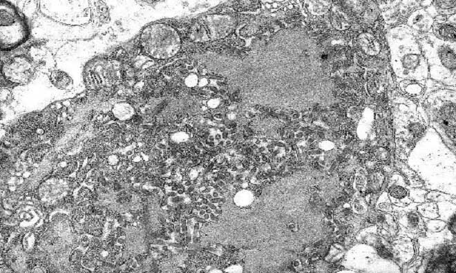Những loại virus nguy hiểm trên Trái Đất