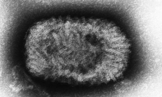 Những loại virus nguy hiểm trên Trái Đất