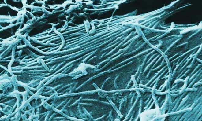Những loại virus nguy hiểm trên Trái Đất
