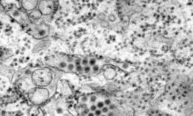 Những loại virus nguy hiểm trên Trái Đất