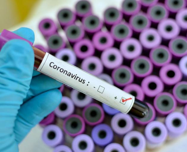 Australia tuyên bố đột phá trong việc kiềm chế virus corona