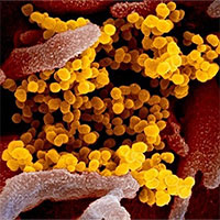 Ảnh chụp virus nCoV xuất hiện trên bề mặt tế bào