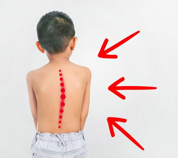 Vì sao trẻ thường đi bằng mũi chân?