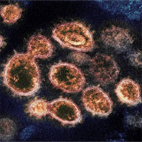 Khả năng bám dính tế bào của virus SARS-CoV-2 mạnh hơn SARS 1.000 lần