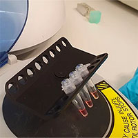 Kit thử SARS-CoV-2 nhanh gấp 3 lần bình thường