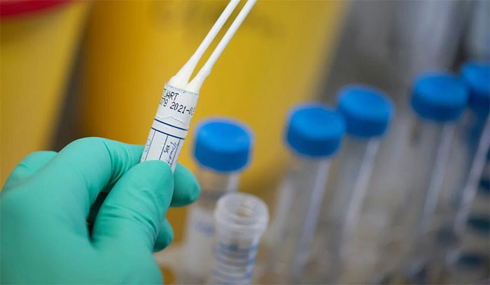 Tại sao virus corona không 