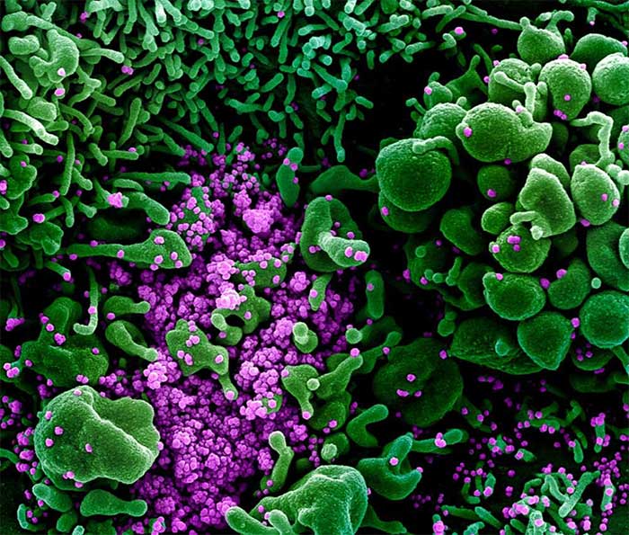 Ảnh chụp virus nCoV 