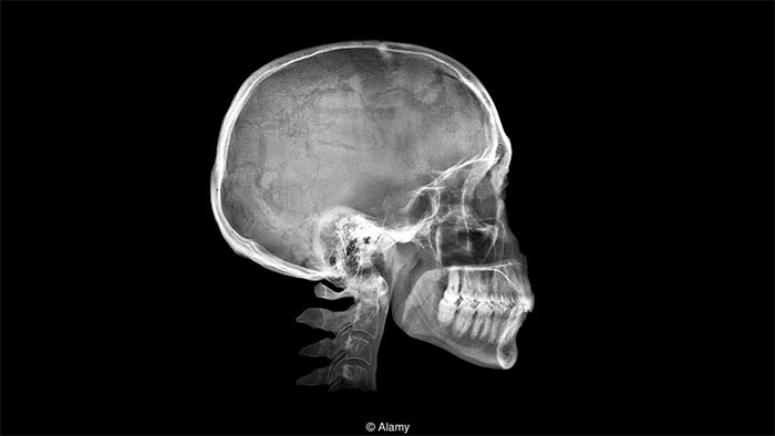 Cuộc sống hiện đại đang khiến bộ xương chúng ta thay đổi ra sao?