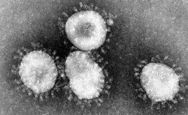 Những điều cần biết về coronavirus và chủng Sars-Cov-2