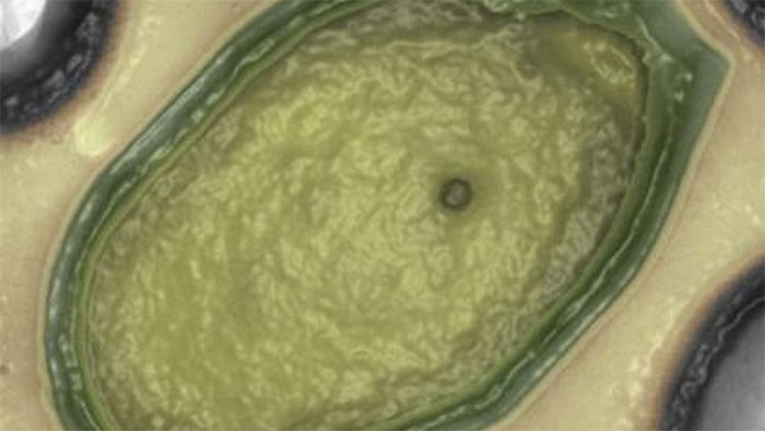 Phát hiện virus khổng lồ nhất thế giới