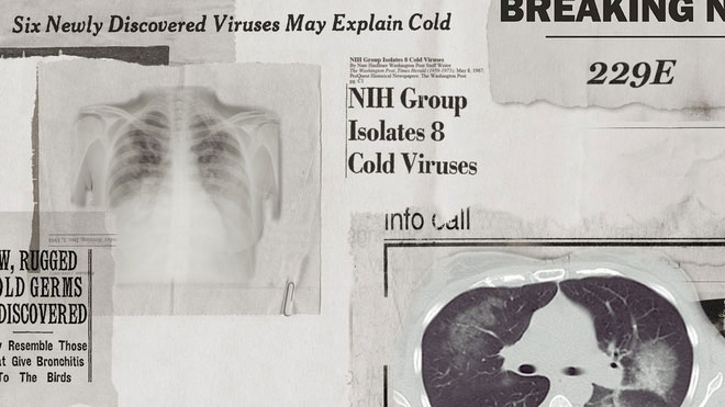 Lịch sử bí ẩn của họ virus corona: Từ cơn cảm lạnh thông thường đến những đại dịch toàn cầu
