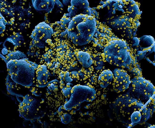 Sản xuất thành công kháng thể diệt virus corona