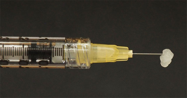Các nhà khoa học phát minh ra loại gel có thể hàn gắn mọi vết thương trên cơ thể và cả nội tạng