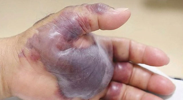 Đi du lịch biển, cần cẩn trọng với những loại đặc sản nào?
