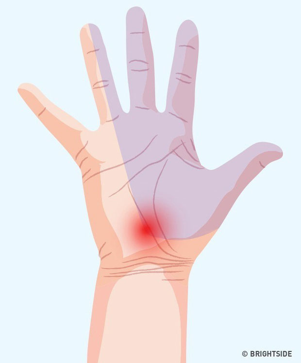 Hãy dừng ngay thói quen đeo chun buộc tóc ở cổ tay nếu không muốn gặp phải tình trạng xấu này