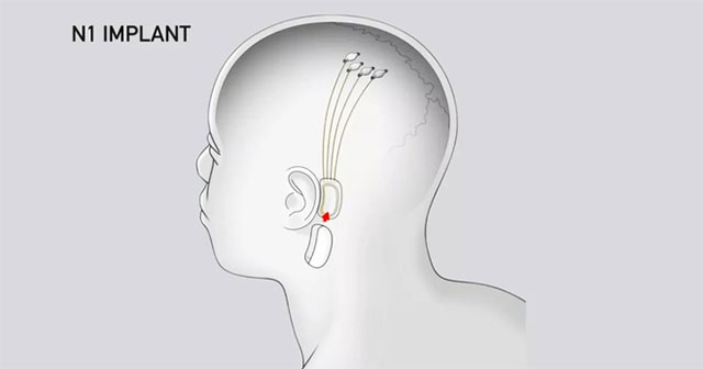 Elon Musk hào hứng giới thiệu cách nghe nhạc mà bạn chưa từng thấy