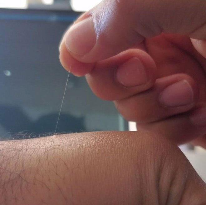 Tại sao một số lông trên cơ thể bạn có thể mọc dài tới mức vô lý?