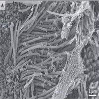 Hình ảnh của tế bào đường thở chứa nCoV