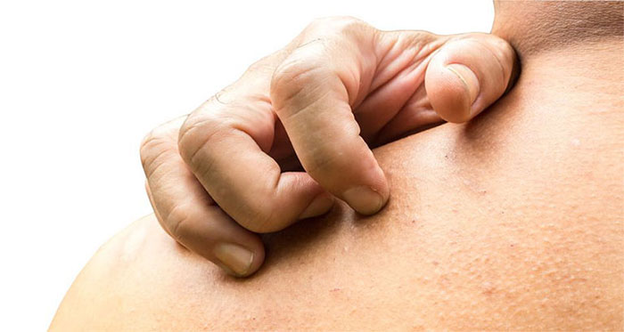 Vì sao khi gãi lại hết ngứa?