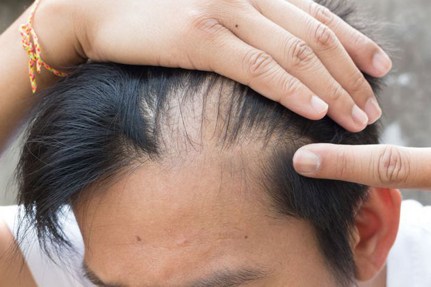 7 đặc điểm cho thấy con người chúng ta vẫn đang tiếp tục tiến hóa, nhưng nó không tốt đẹp như bạn nghĩ đâu