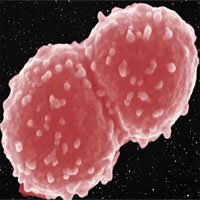 Vi khuẩn Deinococcus radiodurans, sinh vật duy nhất chịu được bức xạ cao