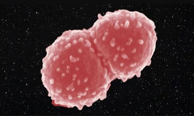 Vi khuẩn Deinococcus radiodurans, sinh vật duy nhất chịu được bức xạ cao