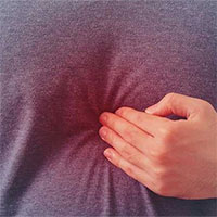 Cẩn trọng khi bị đau bụng vùng thượng vị