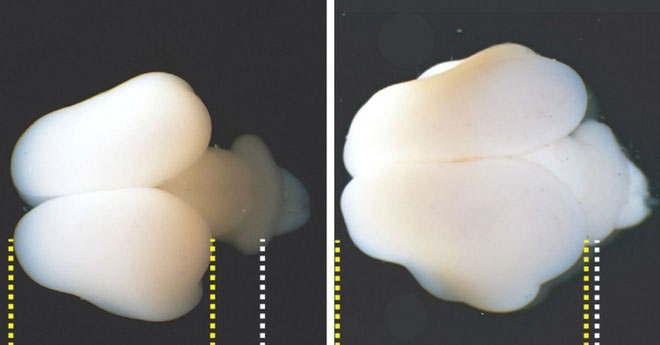 Sử dụng gene người, các nhà nghiên cứu tăng thành công kích cỡ và nếp nhăn của não khỉ