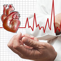 Nhồi máu cơ tim khác đột quỵ não thế nào?