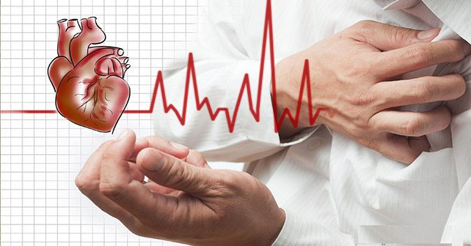 Nhồi máu cơ tim cấp là một cấp cứu tim mạch với những biến chứng nguy hiểm.