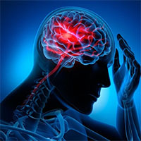Vì sao đột quỵ não thường xảy ra buổi sáng?