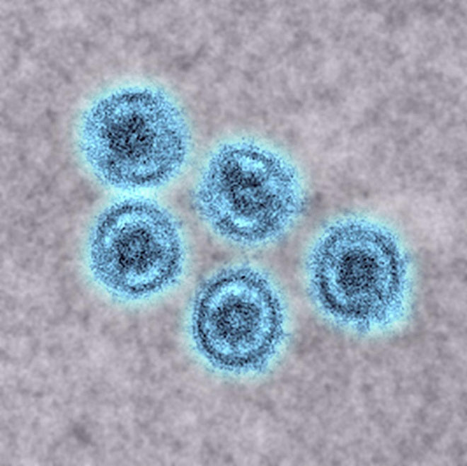Các nhà khoa học lo ngại chủng virus Ebola có khả năng lây sang người