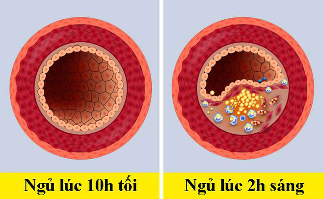 Khi đi ngủ trước hoặc sau 10h tối, cơ thể con người sẽ khác nhau thế nào?