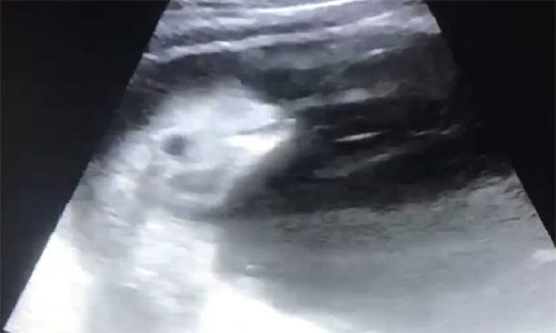 Hình ảnh siêu âm của cá heo đang mang thai.