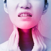 Ung thư hạ họng: Nguyên nhân, triệu chứng và cách điều trị