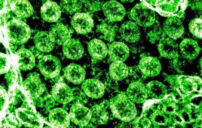 Phát hiện khí ozone có thể khử khuẩn bề mặt có virus corona