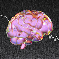 Phát hiện âm thanh bất thường phát ra từ não người