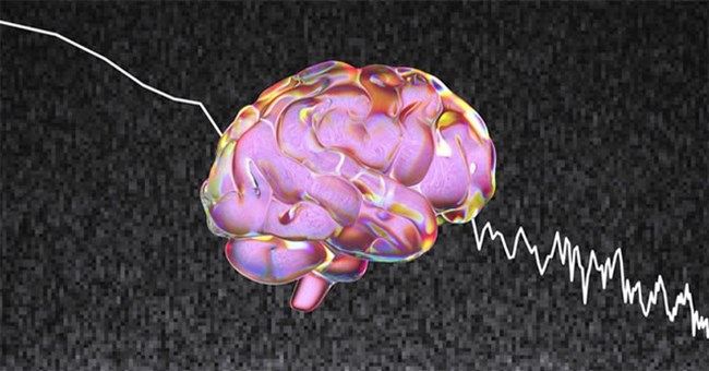 Phát hiện âm thanh bất thường phát ra từ não người