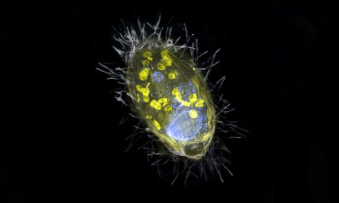 Vi khuẩn nội cộng sinh Candidatus Azoamicus ciliaticola nhìn dưới kính hiển vi.